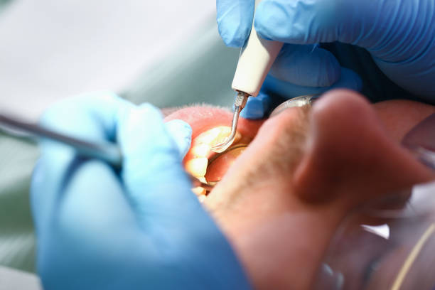 Best Emergency Cosmetic Dentistry in Parchment, MI
